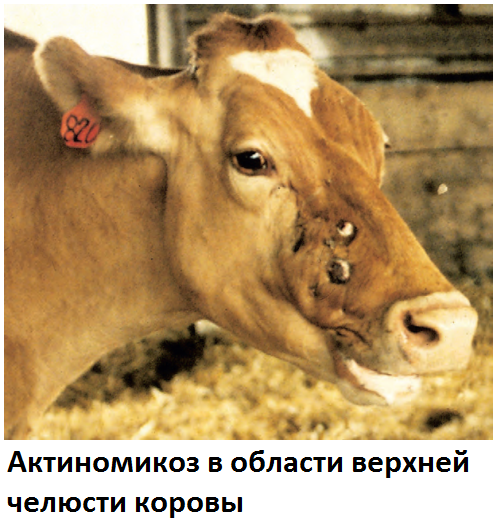 Актиномикоз Актиномикоз